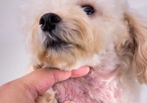 Skin Irritation and allergies