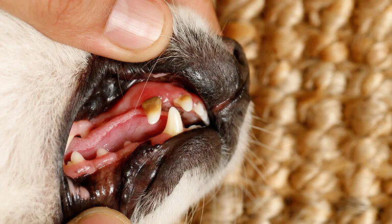 How Dental Neglect Affects Quality of Lif